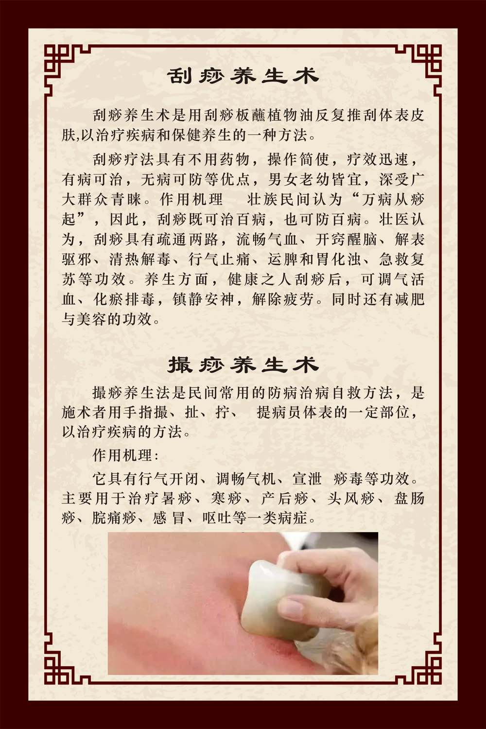 刮痧撮痧